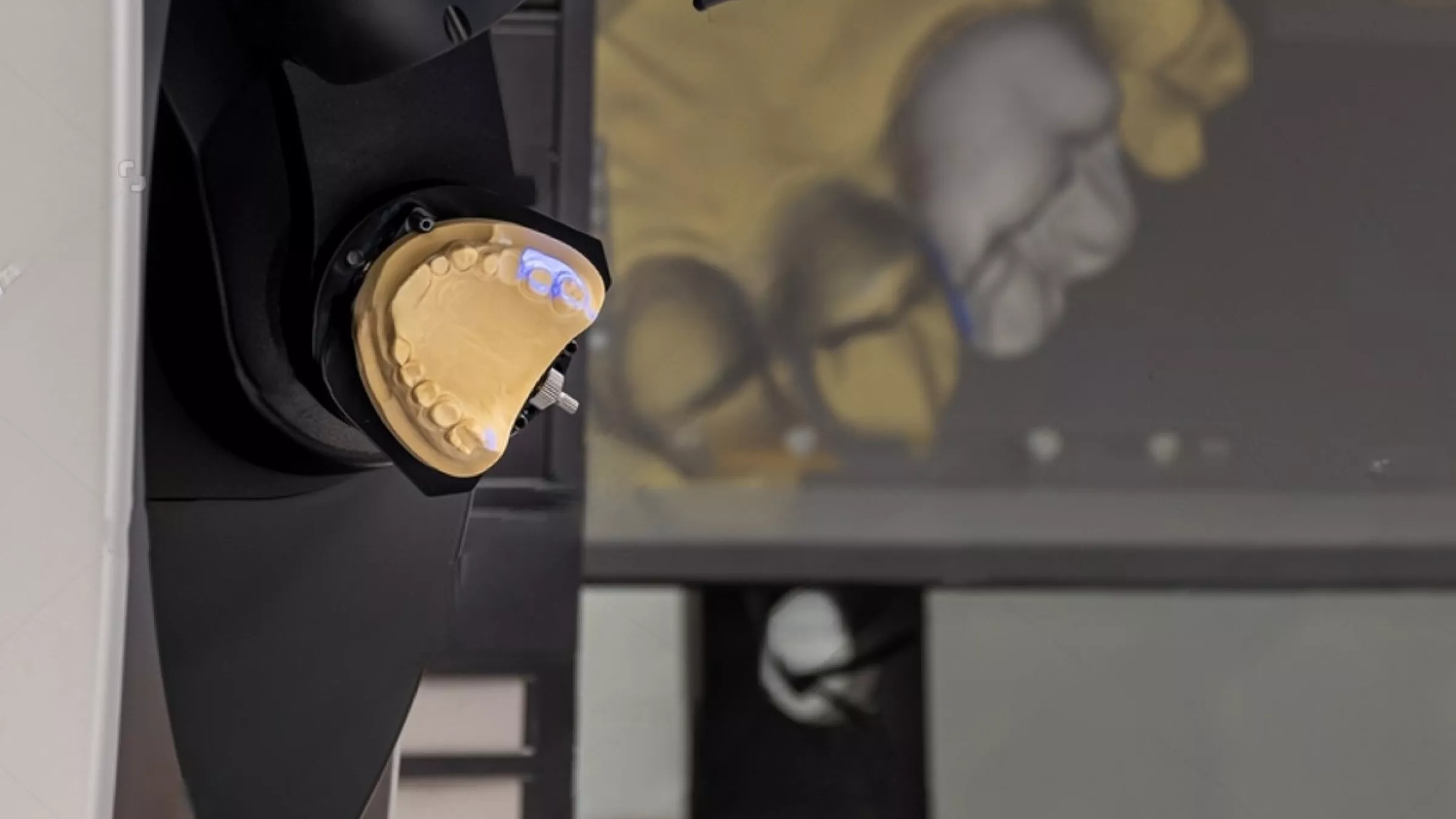 scanner qui scan une machoîre