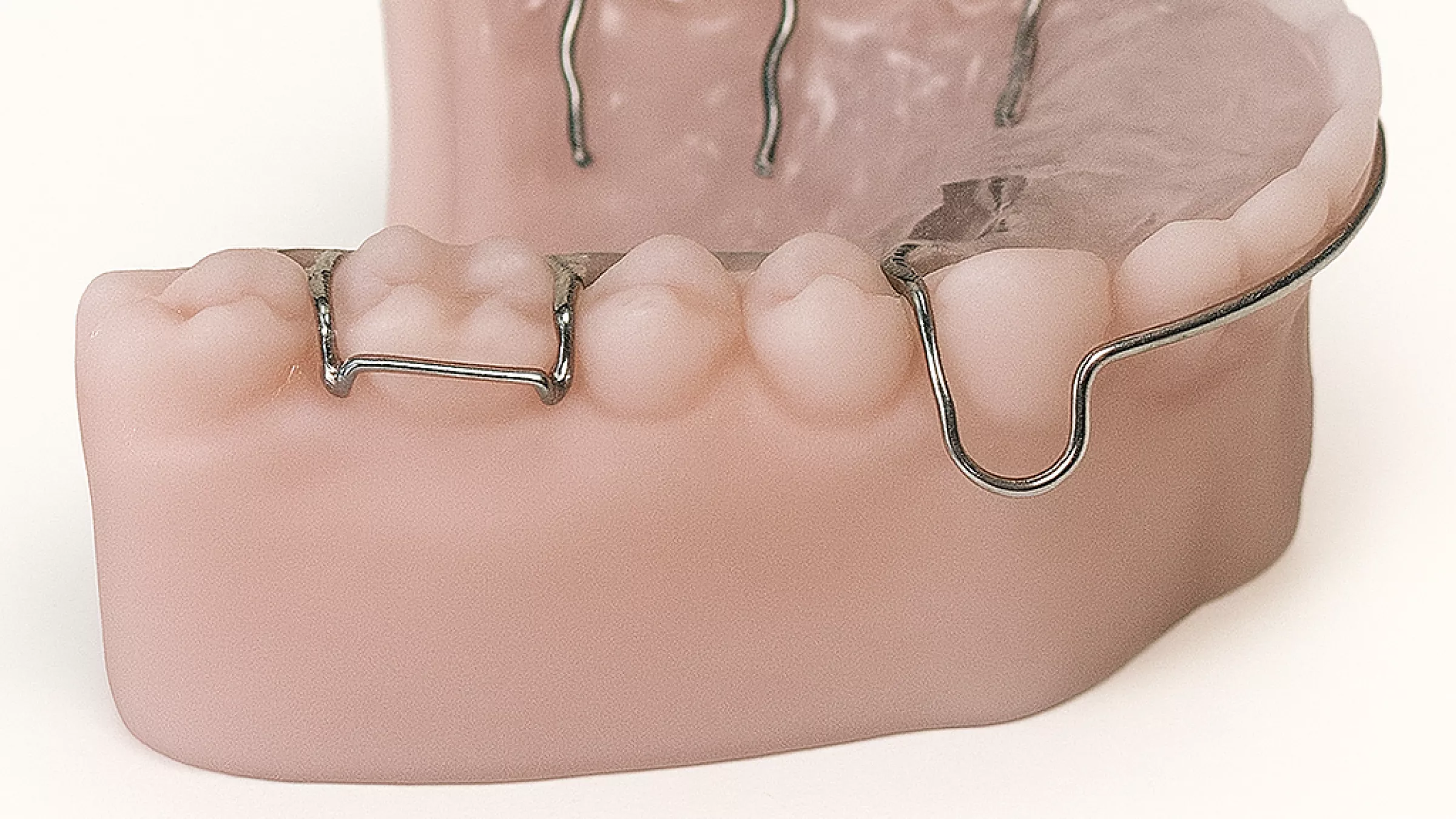plaque orthodontique sur un modèle