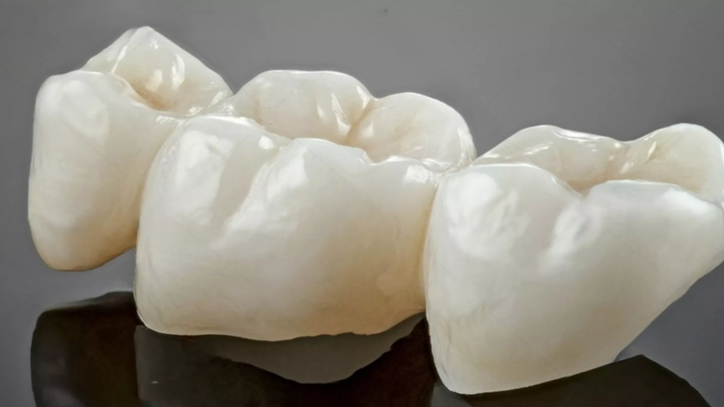 pont fixe en zircon 3 éléments