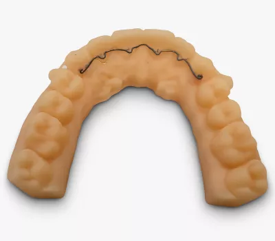 fil de contention sur modèle