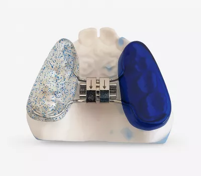 hyrax ou disjoncteur en résine