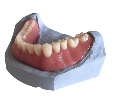 prothèse complète inférieure sur modèle