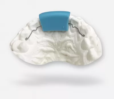 fil de contention sur modèle