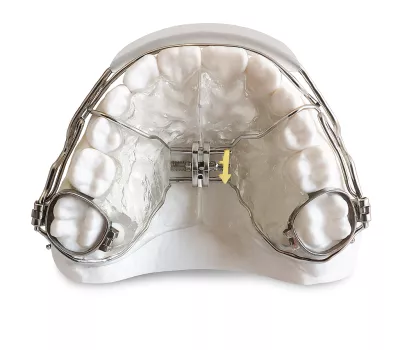 plaque d'expansion lip bumper